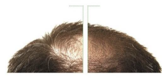 K Pour Karité Anti Hair-Loss Lotion - 200ml