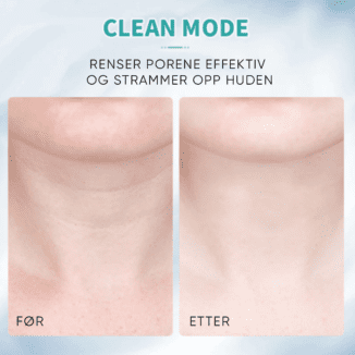 Skin Therapy Sonic LED neck tightening hudoppstrammer